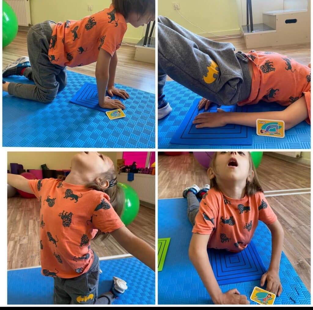 GNB1 kao rijetka genetska bolest