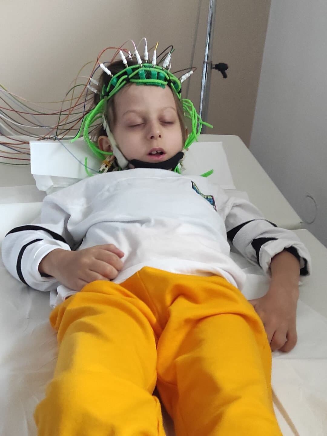 EPILEPSIJA